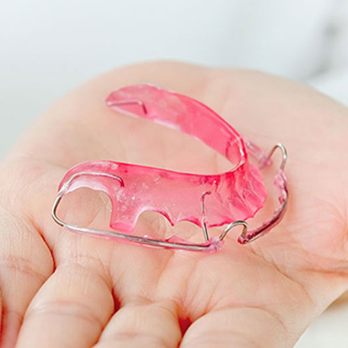 wear a dental retainer in Mississauga as directed by dentist after braces are removed