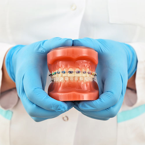 mississauga orthodontist showing mouth model